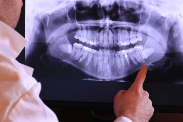 Best Emergency Dental Surgery in Chrisman, IL